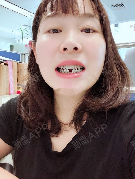 失忆梦：自拔牙齿！