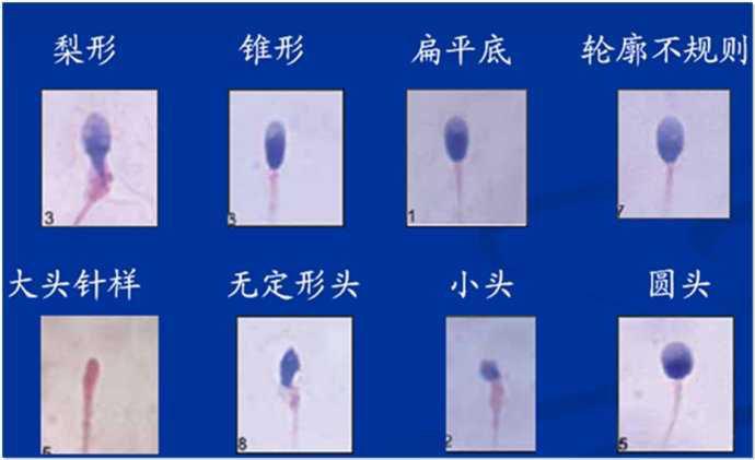 2023年怀孕期间，狗年的哪几个月生男孩的可能性更大？ 狗年的几月最适合生孩子？