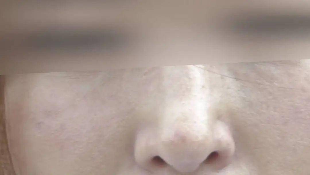 鼻子歪了，心却不能歪