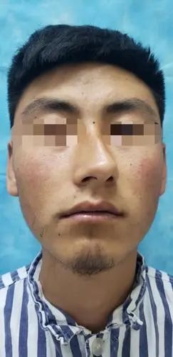对于一个歪鼻子的人来说意味着什么？