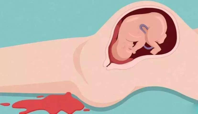 b型血女人的性格特点 B型血女生性格解析