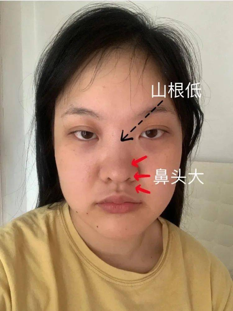 鼻子塌、鼻子小的人意味着什么？