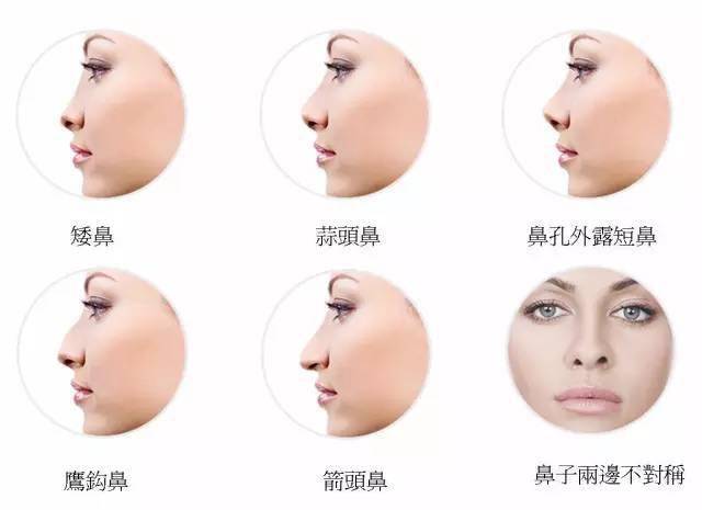 一个大鼻子的男人是什么样的脸？