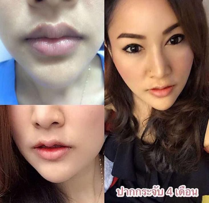 面相和嘴巴图解