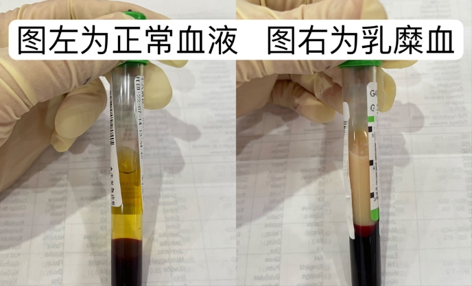 采血管里的血液为什么这么黑?