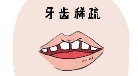 从相学上来说女人牙齿不齐_牙齐的女人是不是有福气_牙齿齐面相