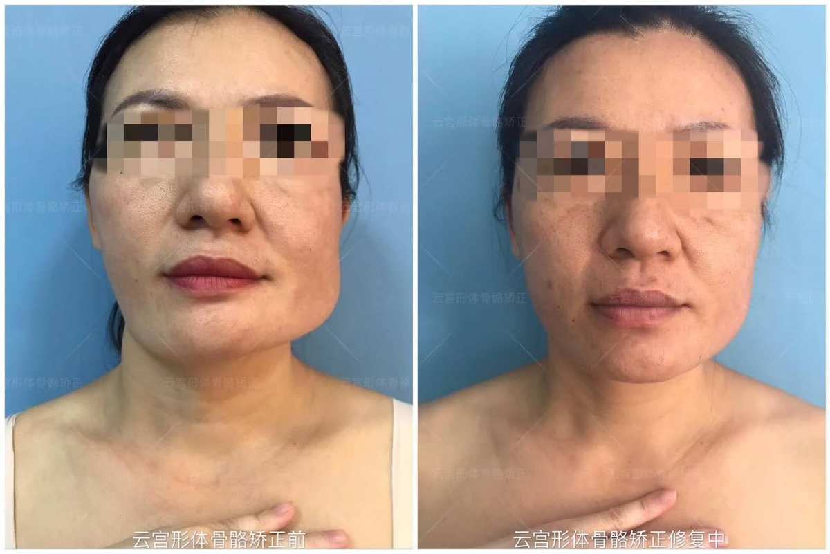 嘴型相术图_嘴形相学_相术嘴型