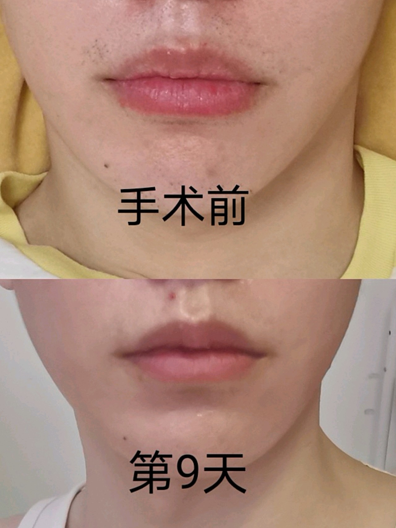 相术小说_性感相术_麻衣相术