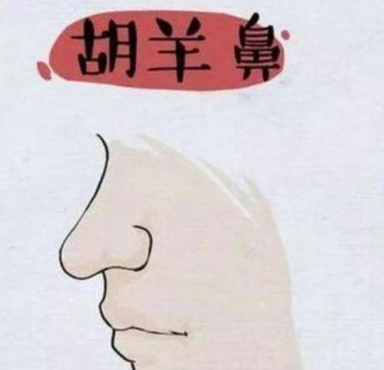 蒜头鼻相术_蒜头鼻相学_看相蒜头鼻