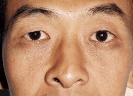 自私面相女人命运_自私的女人面相_自私自利女人面相