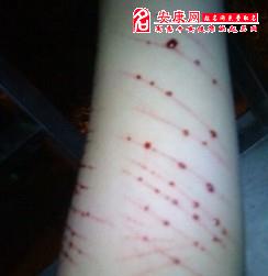 梦见自己受伤流血_流血受伤梦见蛇_流血受伤梦见死人