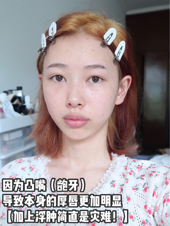 嘴面相图解_面相学嘴唇图解_嘴的面相学