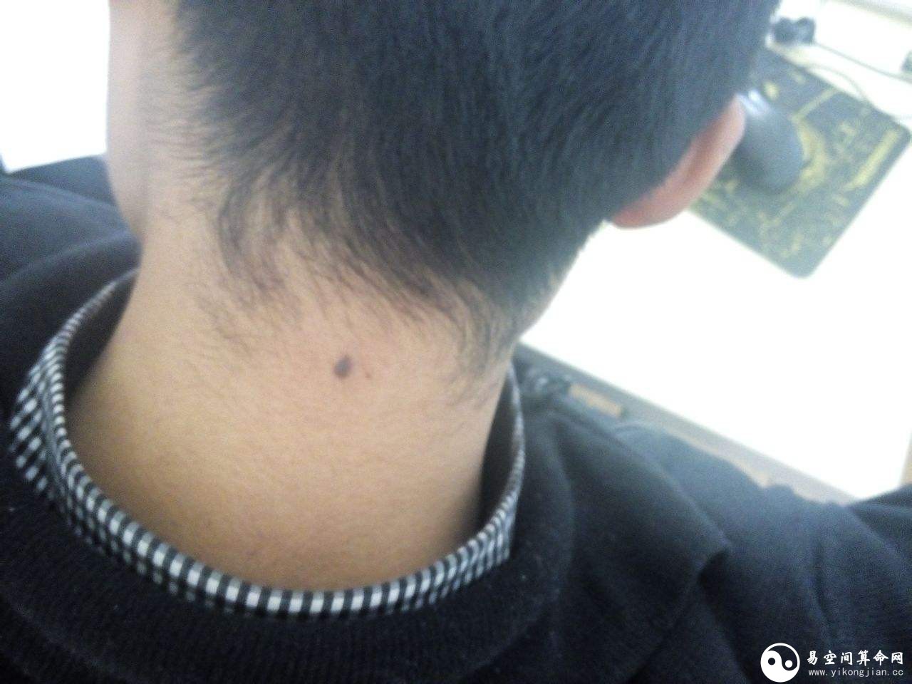 脖子上有痣的男人代表什么 脖颈上右侧有长痣代表什么 脖子上有痣的男人代表什么 脖颈上右侧有长痣代表什么