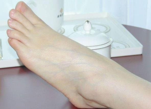 什么是希腊脚 希腊脚的女人什么命 什么是希腊脚 希腊脚的女人什么命